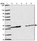 Anti-PSMA4 antibody produced in rabbit Prestige Antibodies® Powered by Atlas Antibodies, affinity isolated antibody, buffered aqueous glycerol solution