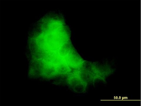 Monoclonal Anti-S100A7 antibody produced in mouse clone 1C1, purified immunoglobulin, buffered aqueous solution