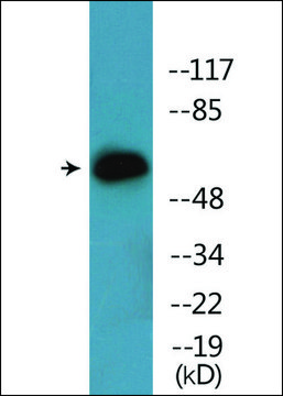 Anti-phospho-IL-2R &#946; (pTyr364) antibody produced in rabbit affinity isolated antibody