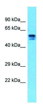 Anti-PDE4D (C-terminal) antibody produced in rabbit affinity isolated antibody