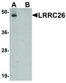 Anti-LRRC26 antibody produced in rabbit affinity isolated antibody