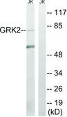 Anti-GRK2 antibody produced in rabbit affinity isolated antibody