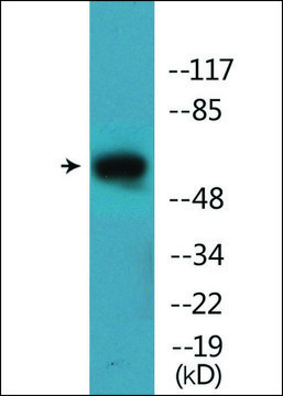 Anti-phospho-STK39 (pSer311) antibody produced in rabbit affinity isolated antibody