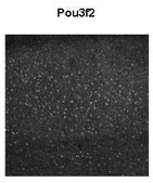 Anti-POU3F2 (AB2) antibody produced in rabbit affinity isolated antibody