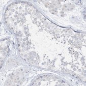 Anti-ETHE1 antibody produced in rabbit Prestige Antibodies® Powered by Atlas Antibodies, affinity isolated antibody, buffered aqueous glycerol solution, ab1