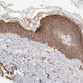 Anti-TYK2 antibody produced in rabbit Prestige Antibodies® Powered by Atlas Antibodies, affinity isolated antibody, buffered aqueous glycerol solution