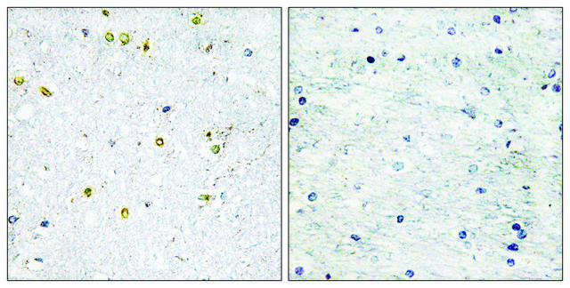 Anti-TRIM24 antibody produced in rabbit affinity isolated antibody