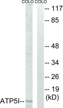 Anti-ATP5I antibody produced in rabbit affinity isolated antibody