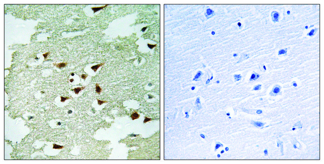 Anti-AKT antibody produced in rabbit affinity isolated antibody