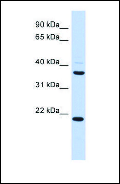 Anti-TMEM74 antibody produced in rabbit affinity isolated antibody