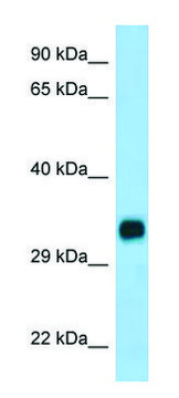 Anti-CH25H (C-terminal) antibody produced in rabbit affinity isolated antibody