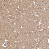 Anti-TTLL4 antibody produced in rabbit Prestige Antibodies® Powered by Atlas Antibodies, affinity isolated antibody, buffered aqueous glycerol solution