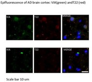 Anti-Aβ-42 Antibody, oligomeric (VIA) serum, from rabbit