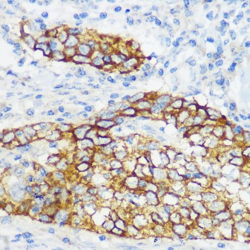 Anti-Collagen XVII/COL17A1 Antibody, clone 8W2C8, Rabbit Monoclonal