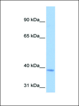 Anti-NSUN3 antibody produced in rabbit affinity isolated antibody