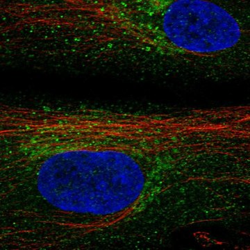 Anti-Timp3 Antibody Produced In Rabbit Prestige Antibodies&#174; Powered by Atlas Antibodies, affinity isolated antibody, buffered aqueous glycerol solution