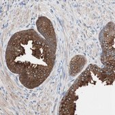 Anti-CCT3 antibody produced in rabbit Prestige Antibodies® Powered by Atlas Antibodies, affinity isolated antibody, buffered aqueous glycerol solution