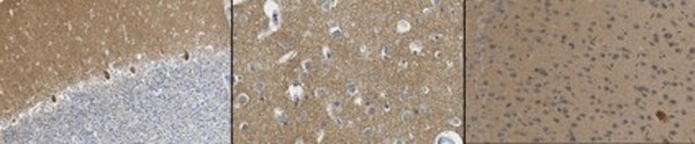 Anti-Septin-3 Antibody, clone 5C1.2 clone 5C1.2, from mouse