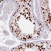 Monoclonal Anti-ATAD2 antibody produced in mouse Prestige Antibodies® Powered by Atlas Antibodies, clone CL0182, purified immunoglobulin, buffered aqueous glycerol solution