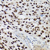 Anti-p63 Antibody, clone 3M9X7, Rabbit Monoclonal