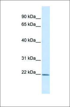 Anti-ZFAND5 antibody produced in rabbit affinity isolated antibody