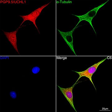 Anti-PGP9.5/UCHL1 Antibody, clone 2Q2S8, Rabbit Monoclonal