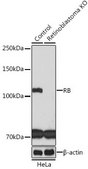 Anti- RB antibody produced in rabbit