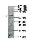Anti-CTPS (AB1) antibody produced in rabbit IgG fraction of antiserum