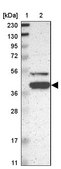 Anti-KLHDC8B antibody produced in rabbit Prestige Antibodies® Powered by Atlas Antibodies, affinity isolated antibody, buffered aqueous glycerol solution
