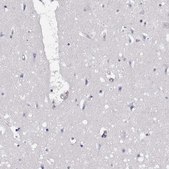 Anti-EML4 antibody produced in rabbit Prestige Antibodies® Powered by Atlas Antibodies, affinity isolated antibody, buffered aqueous glycerol solution