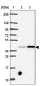 Anti-SLC39A3 antibody produced in rabbit Prestige Antibodies® Powered by Atlas Antibodies, affinity isolated antibody, buffered aqueous glycerol solution