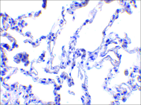 Anti-P53R2 antibody produced in rabbit affinity isolated antibody, buffered aqueous solution