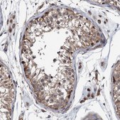 Anti-ITIH3 antibody produced in rabbit Prestige Antibodies® Powered by Atlas Antibodies, affinity isolated antibody, buffered aqueous glycerol solution
