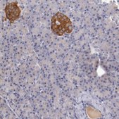 Anti-SYP antibody produced in rabbit Prestige Antibodies® Powered by Atlas Antibodies, affinity isolated antibody, buffered aqueous glycerol solution