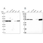 Anti-PRPF19 antibody produced in rabbit Prestige Antibodies® Powered by Atlas Antibodies, affinity isolated antibody, buffered aqueous glycerol solution