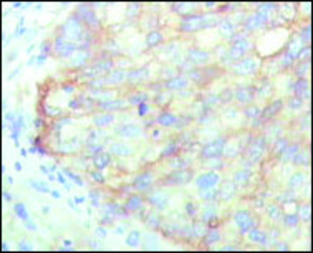 Monoclonal Anti-KARS antibody produced in mouse clone 8G12C1, ascites fluid