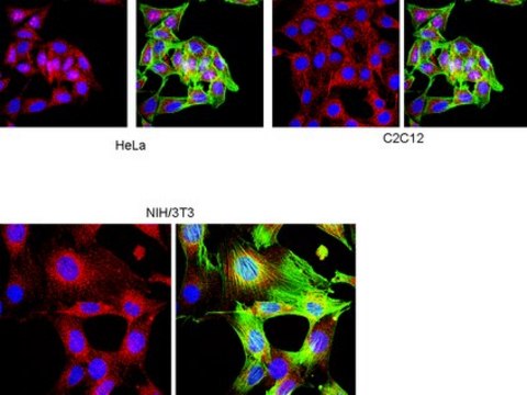 Anti-Prohormone Convertase PC1/PC3 Antibody from rabbit, purified by affinity chromatography