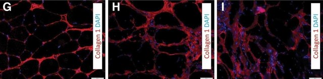 Anti-Rat Collagen Type I Antibody Chemicon&#174;, from rabbit