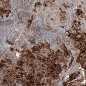 Anti-WFDC2 antibody produced in mouse Prestige Antibodies® Powered by Atlas Antibodies, clone CL12886, purified by using Protein A, buffered aqueous glycerol solution