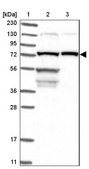 Anti-LSS antibody produced in rabbit Prestige Antibodies® Powered by Atlas Antibodies, affinity isolated antibody, buffered aqueous glycerol solution