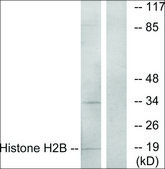 Anti-Histone H2B antibody produced in rabbit affinity isolated antibody