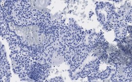 Anti-Fibrillin-1 Antibody, clone 6C19 ZooMAb® Rabbit Monoclonal recombinant, expressed in HEK 293 cells