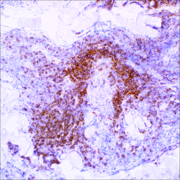 IgD (EP173) Rabbit Monoclonal Primary Antibody