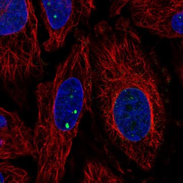 Anti-PLXDC2 antibody produced in rabbit Prestige Antibodies&#174; Powered by Atlas Antibodies, affinity isolated antibody