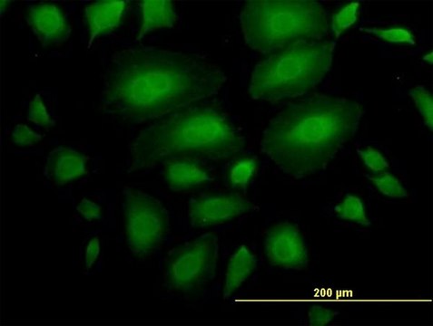 Anti-ANKS1A antibody produced in mouse purified immunoglobulin, buffered aqueous solution