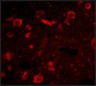 Anti-Slitrk6 (ab1) antibody produced in rabbit affinity isolated antibody, buffered aqueous solution