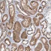 Anti-RAB17 antibody produced in rabbit Prestige Antibodies® Powered by Atlas Antibodies, affinity isolated antibody, buffered aqueous glycerol solution