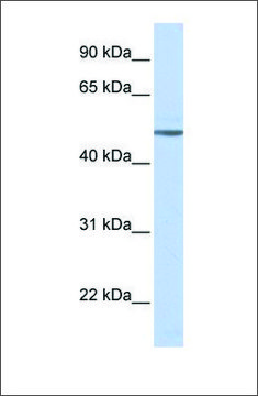 Anti-ADRB1 antibody produced in rabbit affinity isolated antibody