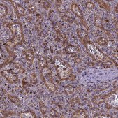 Anti-CASKIN2 Prestige Antibodies® Powered by Atlas Antibodies, affinity isolated antibody