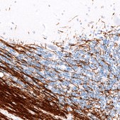 Monoclonal Anti-PLP1 antibody produced in mouse Prestige Antibodies® Powered by Atlas Antibodies, clone CL10622, purified antibody (Protein A)